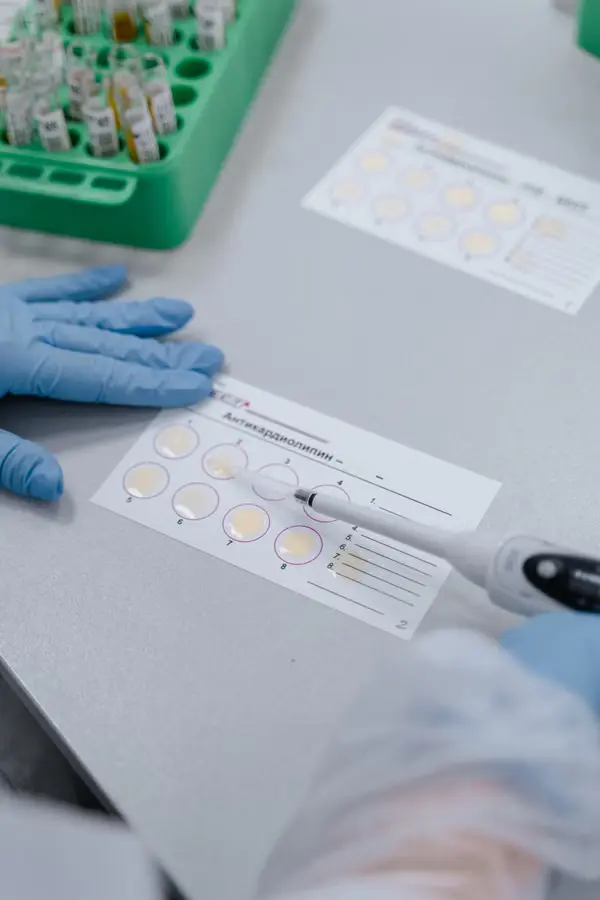 Technician pipetting a sample during laboratory analysis